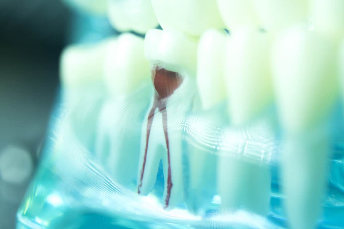 Root Canal Dentists Teeth Model