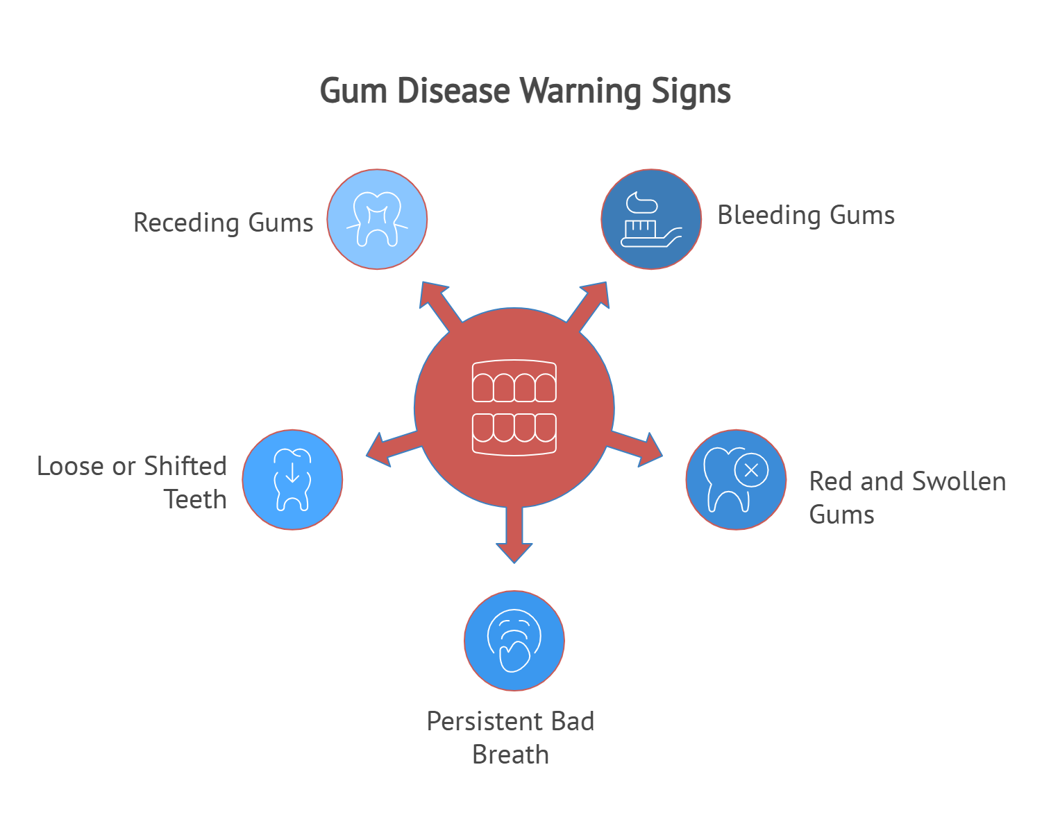diagram graphic explaining gum disease